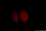 DPF2 Antibody in Immunocytochemistry (ICC/IF)