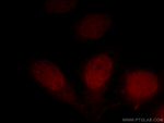 DPF2 Antibody in Immunocytochemistry (ICC/IF)