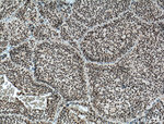 DPF2 Antibody in Immunohistochemistry (Paraffin) (IHC (P))