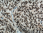 DPF2 Antibody in Immunohistochemistry (Paraffin) (IHC (P))