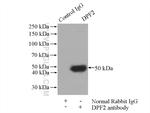 DPF2 Antibody in Immunoprecipitation (IP)