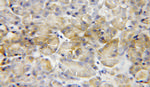 MCCC2 Antibody in Immunohistochemistry (Paraffin) (IHC (P))