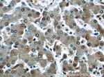 RAD23B Antibody in Immunohistochemistry (Paraffin) (IHC (P))