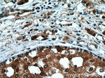 RAD23B Antibody in Immunohistochemistry (Paraffin) (IHC (P))