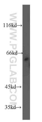 RAD23B Antibody in Western Blot (WB)