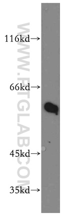 RAD23B Antibody in Western Blot (WB)