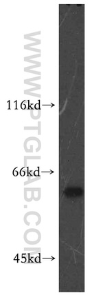 RAD23B Antibody in Western Blot (WB)