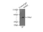 WSB2 Antibody in Immunoprecipitation (IP)