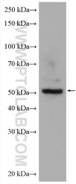 WSB2 Antibody in Western Blot (WB)