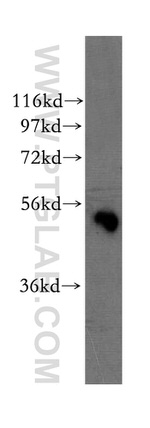 WSB2 Antibody in Western Blot (WB)