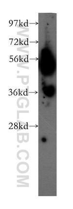 WSB2 Antibody in Western Blot (WB)