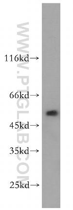 WSB2 Antibody in Western Blot (WB)