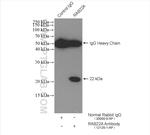 RAB22A Antibody in Immunoprecipitation (IP)
