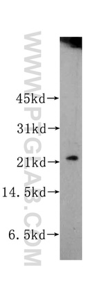RAB22A Antibody in Western Blot (WB)