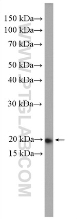 RAB22A Antibody in Western Blot (WB)