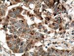 SYTL4 Antibody in Immunohistochemistry (Paraffin) (IHC (P))