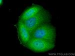 SNAI2 Antibody in Immunocytochemistry (ICC/IF)