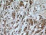 SNAI2 Antibody in Immunohistochemistry (Paraffin) (IHC (P))