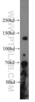 SAP130 Antibody in Western Blot (WB)