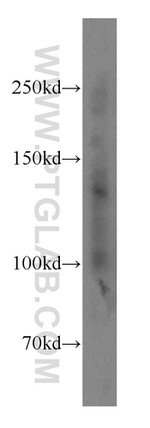 SAP130 Antibody in Western Blot (WB)