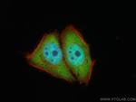 TIA1 Antibody in Immunocytochemistry (ICC/IF)