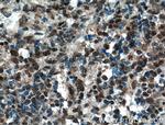 TIA1 Antibody in Immunohistochemistry (Paraffin) (IHC (P))