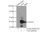 TIA1 Antibody in Immunoprecipitation (IP)
