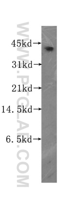 TIA1 Antibody in Western Blot (WB)