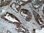 UBE2C Antibody in Immunohistochemistry (Paraffin) (IHC (P))