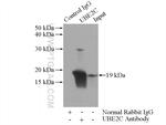 UBE2C Antibody in Immunoprecipitation (IP)