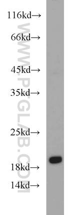 UBE2C Antibody in Western Blot (WB)