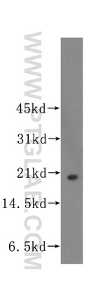 UBE2C Antibody in Western Blot (WB)