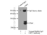 OIP5 Antibody in Immunoprecipitation (IP)