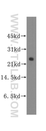 OIP5 Antibody in Western Blot (WB)