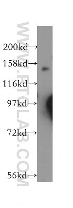 GAK Antibody in Western Blot (WB)