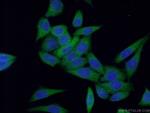 PTS Antibody in Immunocytochemistry (ICC/IF)