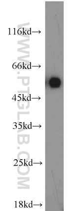 LMBR1L Antibody in Western Blot (WB)