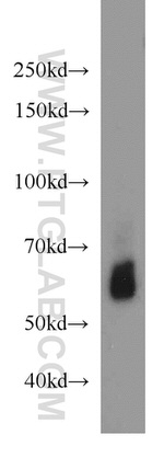 LMBR1L Antibody in Western Blot (WB)