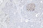 TCN2 Antibody in Immunohistochemistry (Paraffin) (IHC (P))