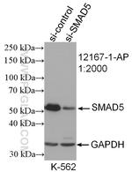 SMAD5 Antibody in Western Blot (WB)
