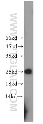 RPE Antibody in Western Blot (WB)