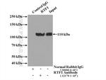 RTF1 Antibody in Immunoprecipitation (IP)