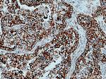 FKBP65 Antibody in Immunohistochemistry (Paraffin) (IHC (P))