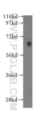 FKBP65 Antibody in Western Blot (WB)