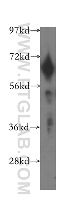 FKBP65 Antibody in Western Blot (WB)