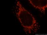 OXCT1 Antibody in Immunocytochemistry (ICC/IF)