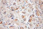 OXCT1 Antibody in Immunohistochemistry (Paraffin) (IHC (P))