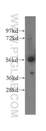 OXCT1 Antibody in Western Blot (WB)