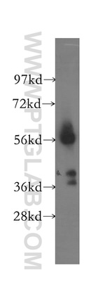 OXCT1 Antibody in Western Blot (WB)