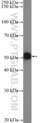 OXCT1 Antibody in Western Blot (WB)